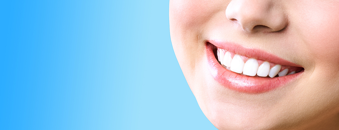 Bleaching in Gießen: Zahnaufhellung für weißere Zähne